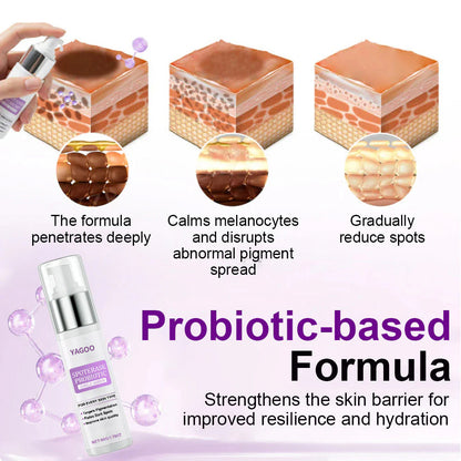 🌟YAGOO® 𝐒𝐩𝐨𝐭𝐄𝐫𝐚𝐬𝐞 𝐏𝐫𝐨𝐛𝐢𝐨𝐭𝐢𝐜 𝐒𝐡𝐢𝐞𝐥𝐝 𝐒𝐞𝐫𝐮𝐦 – Fades Dark Spots, Evens Skin Tone & Boosts Radiance✨💜