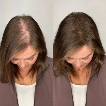 2026  🔥LAST DAY50%OFF  🔥Rosemary Hydrolyzed Keratin Shampoo