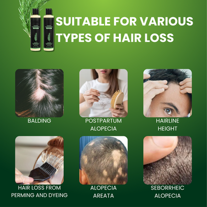 2026  🔥LAST DAY50%OFF  🔥Rosemary Hydrolyzed Keratin Shampoo