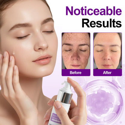 🌟YAGOO® 𝐒𝐩𝐨𝐭𝐄𝐫𝐚𝐬𝐞 𝐏𝐫𝐨𝐛𝐢𝐨𝐭𝐢𝐜 𝐒𝐡𝐢𝐞𝐥𝐝 𝐒𝐞𝐫𝐮𝐦 – Fades Dark Spots, Evens Skin Tone & Boosts Radiance✨💜
