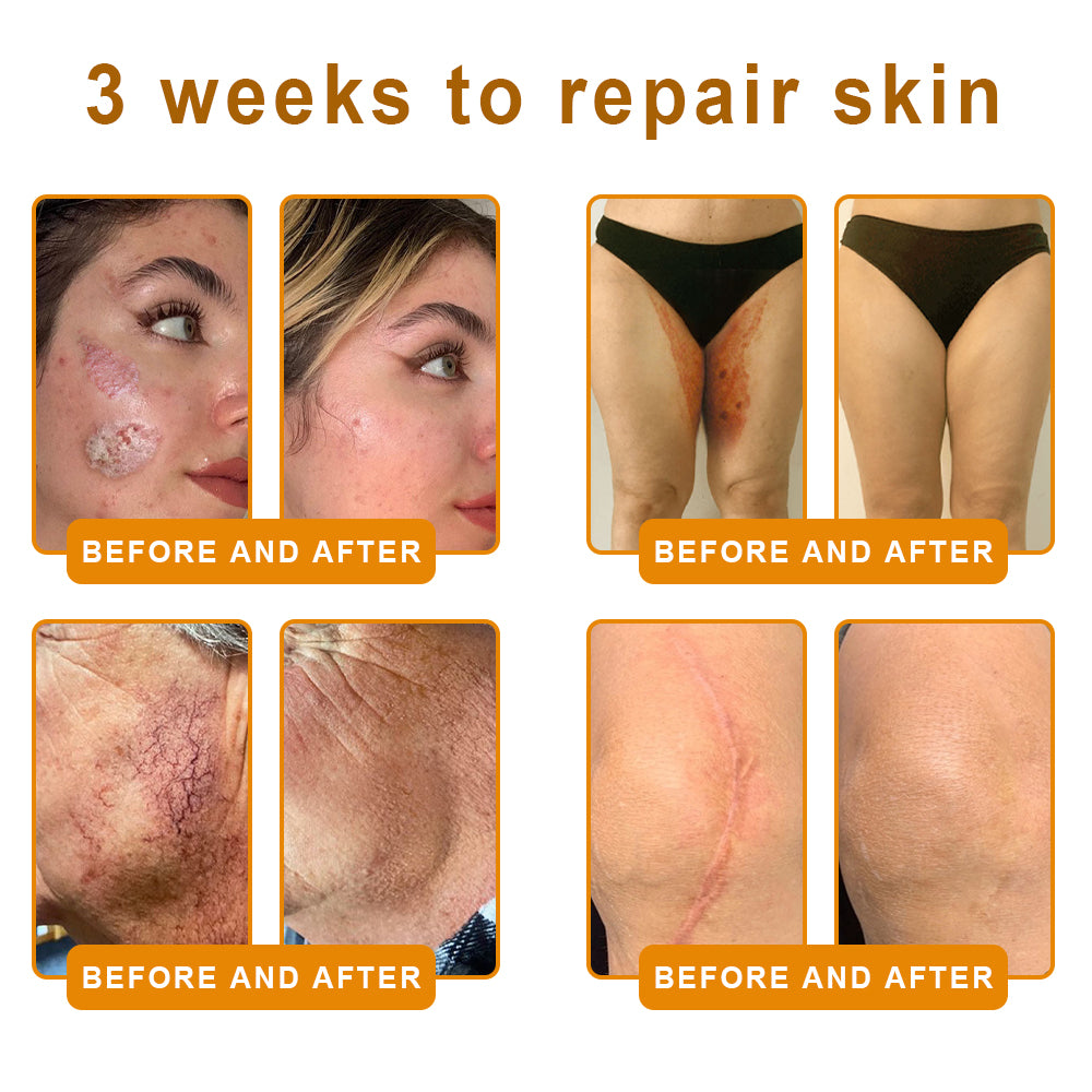 2026🏆✨LAST DAY SALE 80% OFF⏰✨YAGOO™  Bee Venom Skin Restoration Cream — 🔥Limited Time 80% OFF🔥