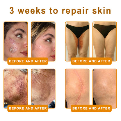 2026🏆✨LAST DAY SALE 80% OFF⏰✨YAGOO™  Bee Venom Skin Restoration Cream — 🔥Limited Time 80% OFF🔥
