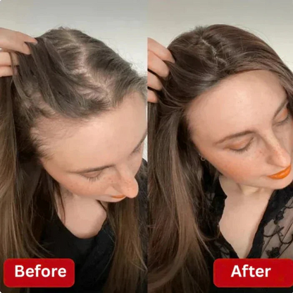 2026  🔥LAST DAY50%OFF  🔥Rosemary Hydrolyzed Keratin Shampoo
