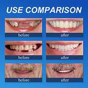 🎄💖Final 3 Hours:50%ОFF💥Yagoo™🦷 YAGOOFirmHold Denture Adhesive — Up to 10 Days of Slip-Free Hold🦷