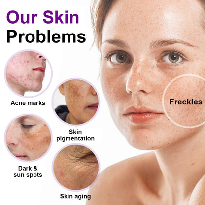 🌟YAGOO® 𝐒𝐩𝐨𝐭𝐄𝐫𝐚𝐬𝐞 𝐏𝐫𝐨𝐛𝐢𝐨𝐭𝐢𝐜 𝐒𝐡𝐢𝐞𝐥𝐝 𝐒𝐞𝐫𝐮𝐦 – Fades Dark Spots, Evens Skin Tone & Boosts Radiance✨💜