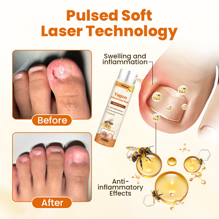 🎄💖Final 3 Hours:50%ОFF💥Yagoo® Advanced Nail Repair Spray