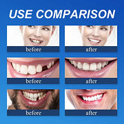 🎄💖Final 3 Hours:50%ОFF💥Yagoo™🦷 YAGOOFirmHold Denture Adhesive — Up to 10 Days of Slip-Free Hold🦷