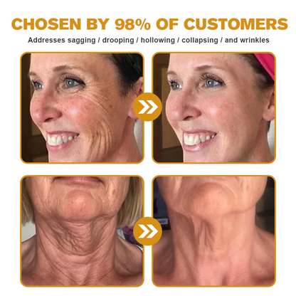 2026🏆✨LAST DAY SALE 80% OFF⏰✨YAGOO™  Bee Venom Skin Restoration Cream — 🔥Limited Time 80% OFF🔥
