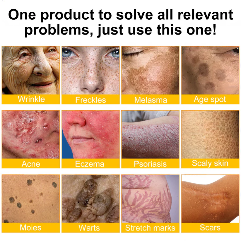 2026🏆✨LAST DAY SALE 80% OFF⏰✨YAGOO™  Bee Venom Skin Restoration Cream — 🔥Limited Time 80% OFF🔥