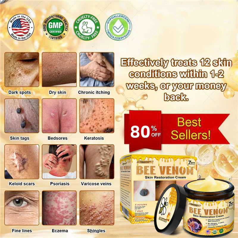 2026🏆✨LAST DAY SALE 80% OFF⏰✨YAGOO™  Bee Venom Skin Restoration Cream — 🔥Limited Time 80% OFF🔥