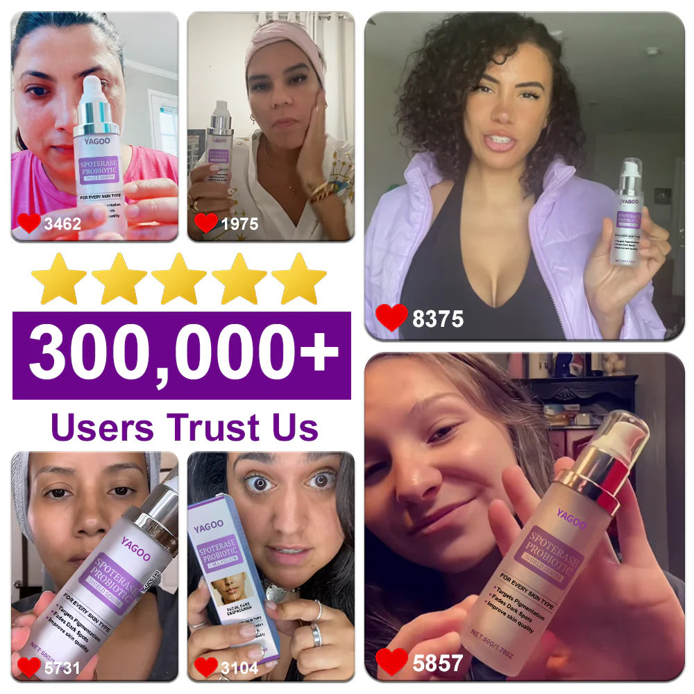 🌟YAGOO® 𝐒𝐩𝐨𝐭𝐄𝐫𝐚𝐬𝐞 𝐏𝐫𝐨𝐛𝐢𝐨𝐭𝐢𝐜 𝐒𝐡𝐢𝐞𝐥𝐝 𝐒𝐞𝐫𝐮𝐦 – Fades Dark Spots, Evens Skin Tone & Boosts Radiance✨💜
